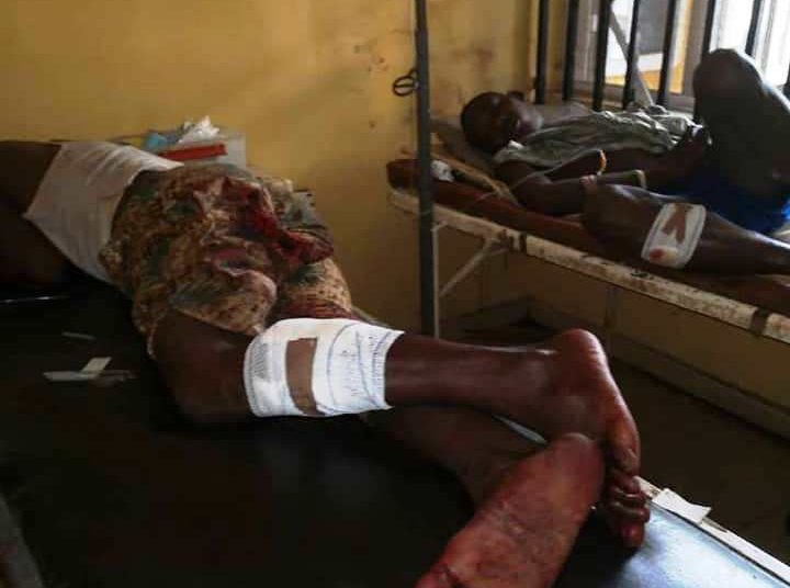 Ojoo - National Insight News Some of he victims receiving  treatments